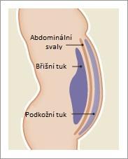 (1,29 mmol/l) - hypertenze systolický tlak krve 130 mm Hg, diastolický TK 85 mm Hg - glykémie na lačno konc. glukózy 100 mg/dl (5,6 mmol/l) Obr.2.