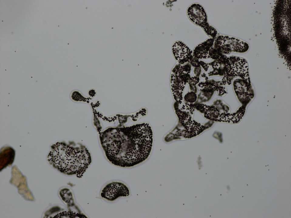 Microcystis