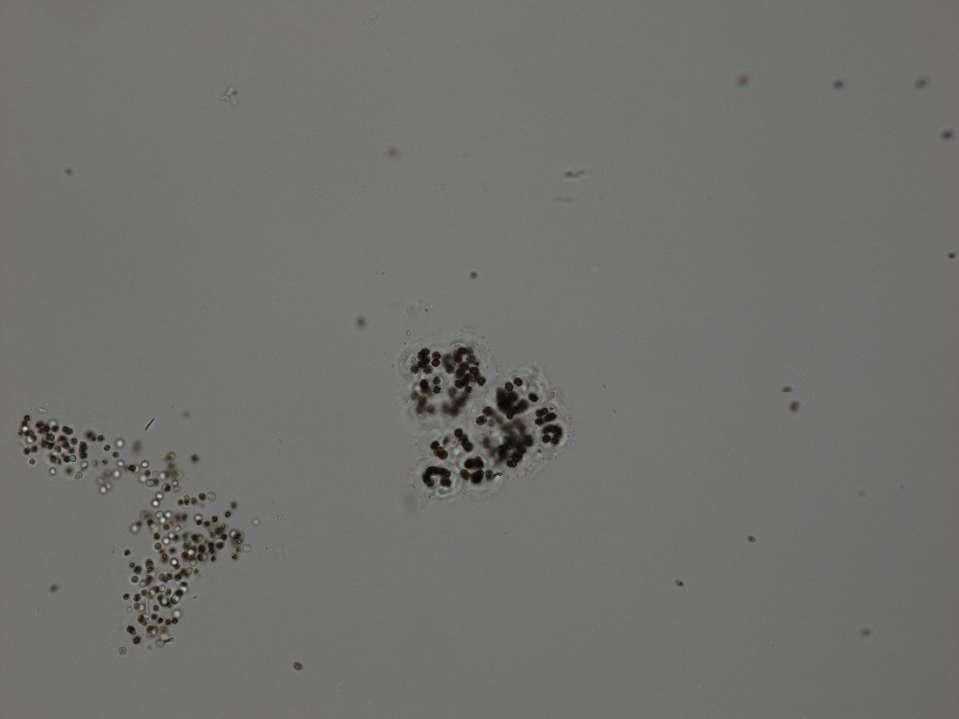 Microcystis