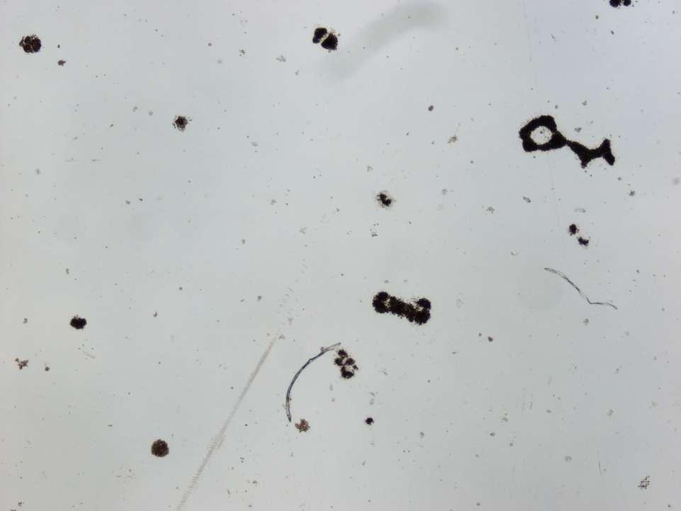 Microcystis