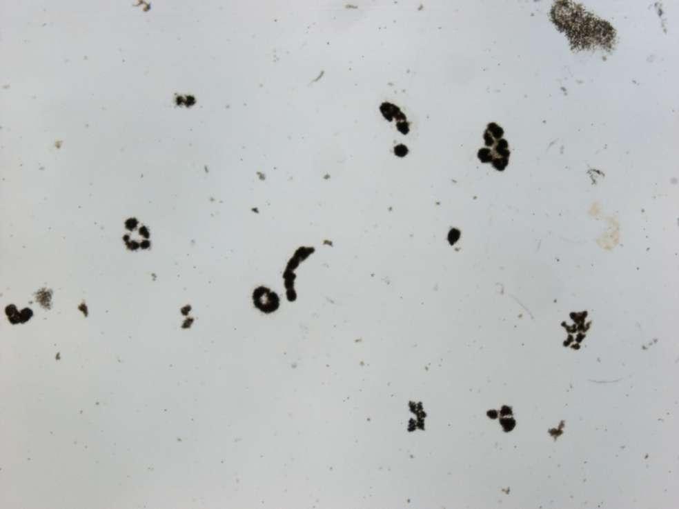 Microcystis