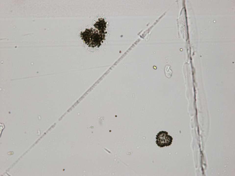 Microcystis aeruginosa