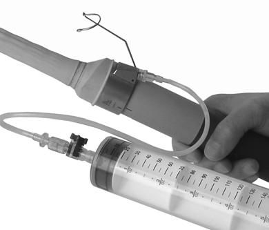 uzavírací ventil Luer 6 Naplňte kondom přibližně 50 ml odplyněné vody. V kondomu se mohou objevit vzduchové bublinky. Ty je potřeba odstranit, aby nevznikly v ultrazvukovém obraze artefakty.