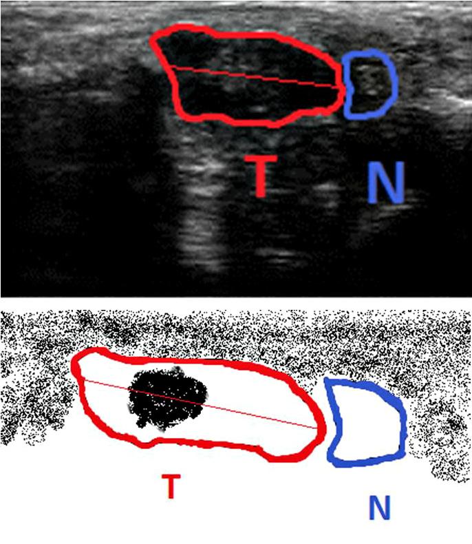 Figure 2. Schematic demonstration of the ultrasonography examination and measurements when the dorsal projection is used (T talus, N navicular bone).