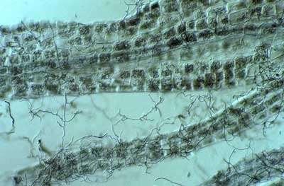 Erikoidní mykorhiza - pouze u zástupců čeledí Ericaceae - tenké kořínky erikoidních rostlin, tzv.