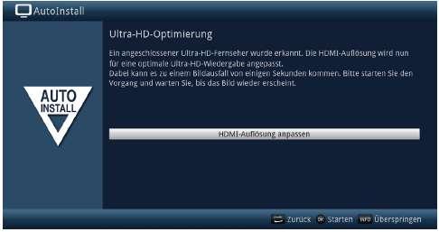 Optimalizace Ultra HD Provozujete-li SONATA 2 spolu s TV přijímačem způsobilým pro UHD (4K), máte nyní možnost, upravit odpovídajícím způsobem rozlišení SONATA 1.