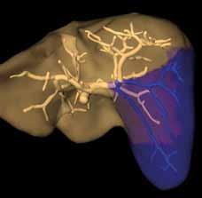 imaging reconstructed according