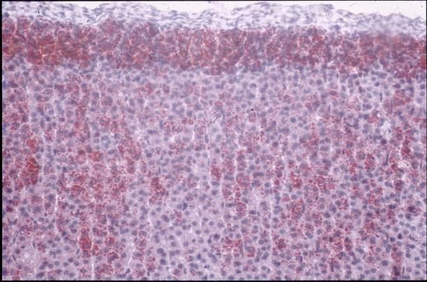 Hypolipoidosis gl.