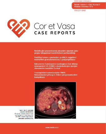2018, 51-55 VA ECMO