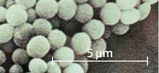 přerůstají v balíčky koky, které se po dělení neoddělily, ale zůstávájí ve čveřicích (např. Micrococcus luteus ) pakety,sarciny (lat.