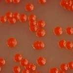 Serratia marcescens. E.