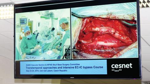 Úspěchy ústecké neurochirurgie za padesát let její existence ocenil předseda představenstva Krajské zdravotní, a. s., Ing. Jiří Novák. Live surgery operace karotidy s živým přenosem (MUDr.