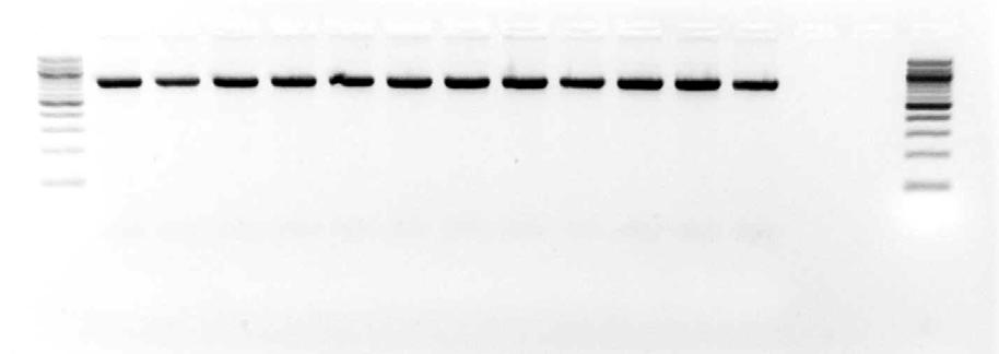 Příklady výsledků PCR analýzy amplifikace části genu TMEM154