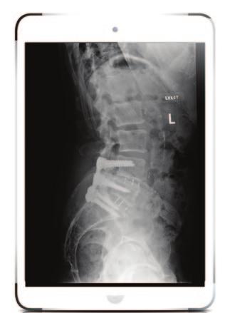FROM THE SPINE The rod is connected in an easy
