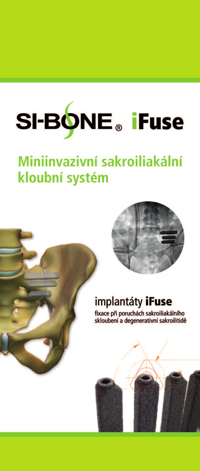 SpineMedicalS Miniinvazivní sakroilikální