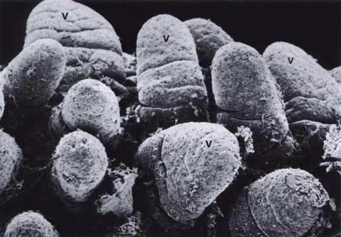 Klky = Villi intestinales prstovité až listovité výběžky asi 10-krát zvětší