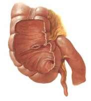 Lanzův bod (na linea interspinosa) Červovitý výběžek slepého střeva = Appendix