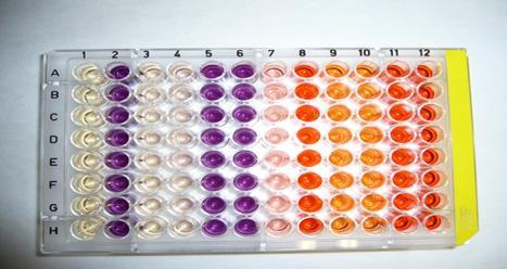 3.1.1 Miniaturizace Potřeba zvýšení počtu chemických sloučenin pro testování a s tím související zvýšení počtu molekulárních cílů vedla k potřebě miniaturizace HTS testů (Mayr et Bojanic, 2009).