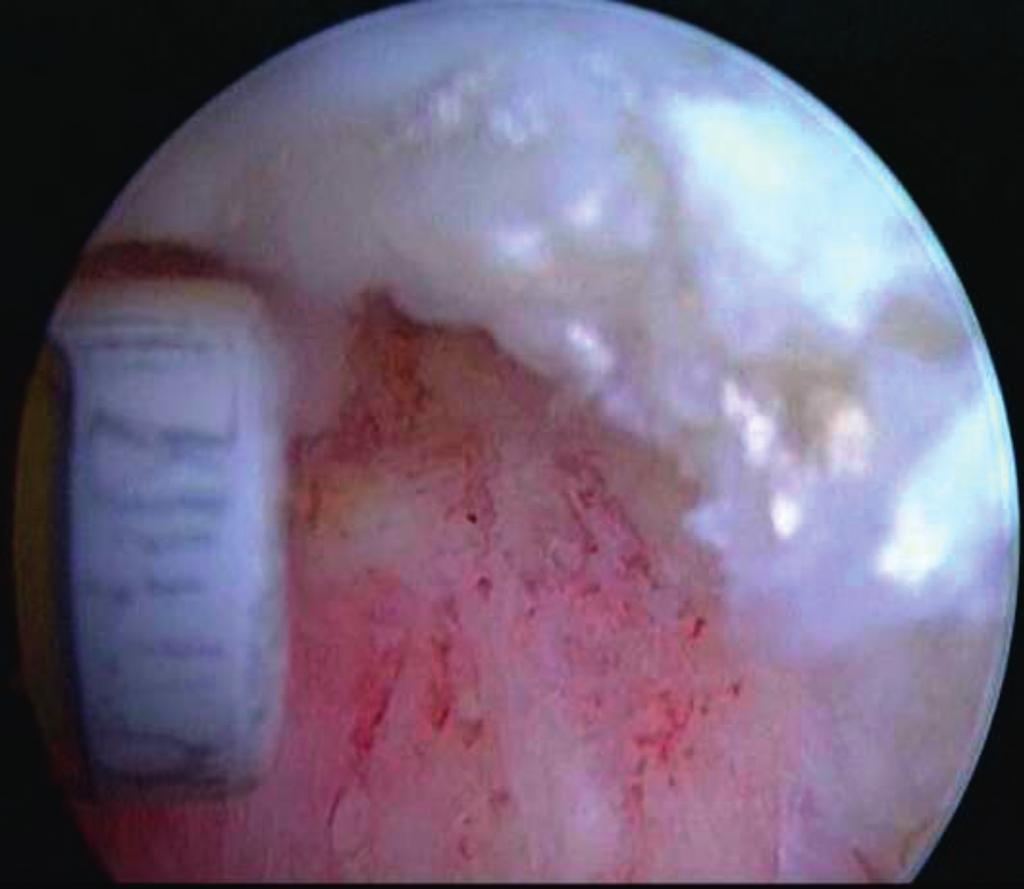 210/ Acta Chir Orthop Traumatol Cech. 85, 2018, No.
