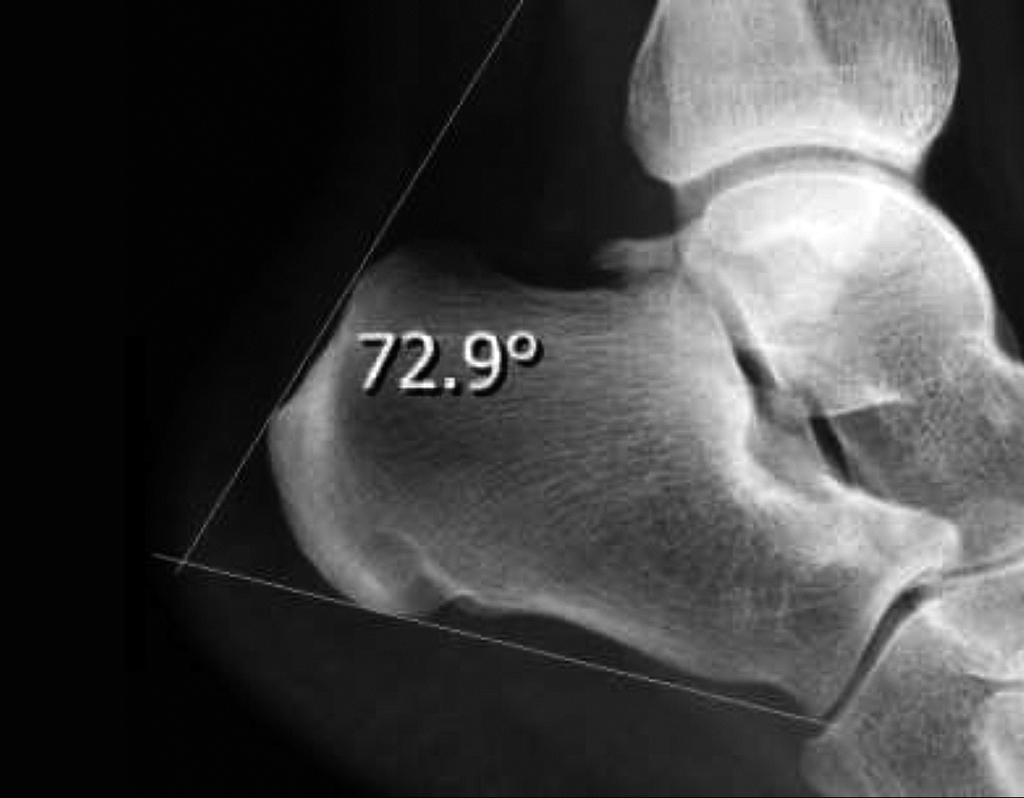 213/ Acta Chir Orthop Traumatol Cech. 85, 2018, No. 3 PŮVODNÍ PRÁCE Tab. 1.