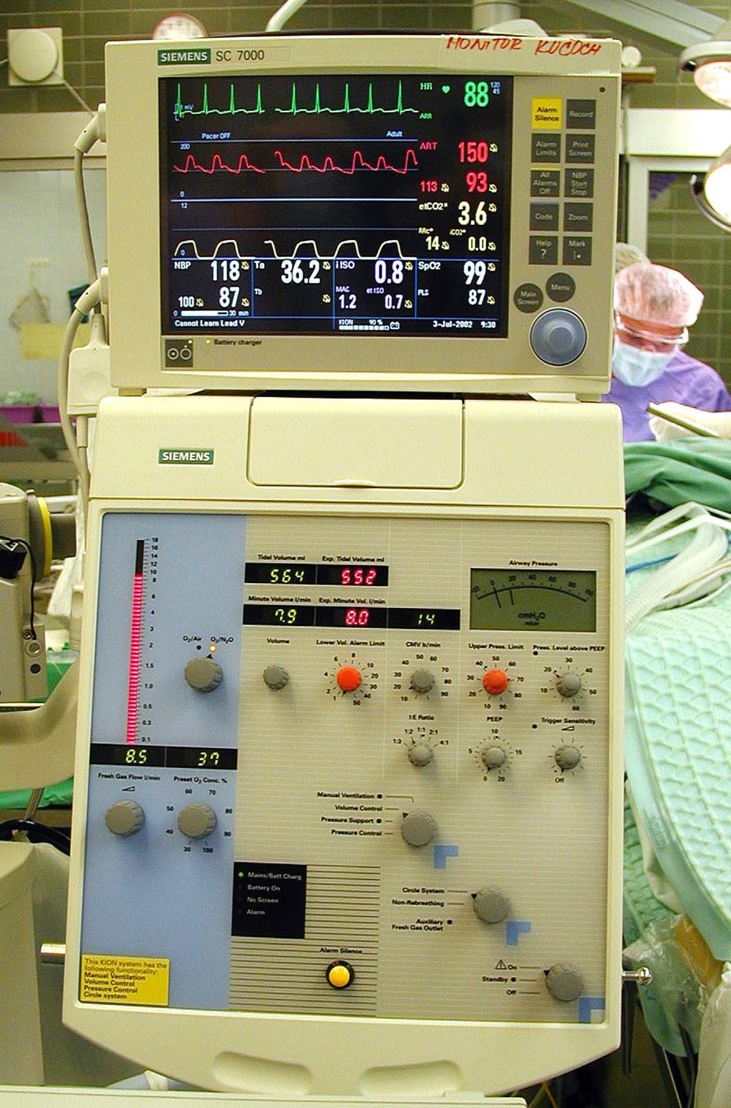 Anestézie mesocain propofol (thiopental) midazolam