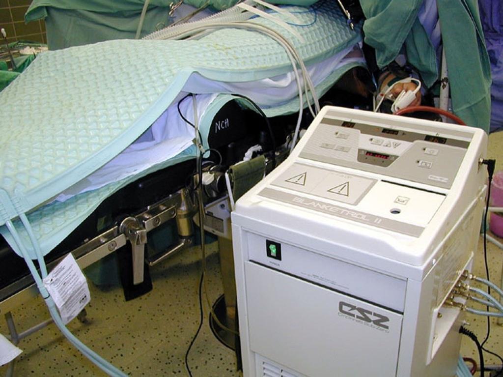 Studie KARIM 90 nemocných po náhlé zástavě oběhu U 43 nemocných