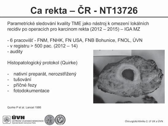 Současný náhled na rozsah resekce u karcinomu kolorekta XXIV.