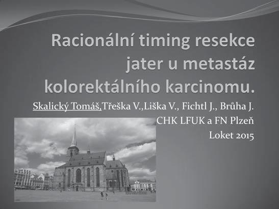 Racionální timing