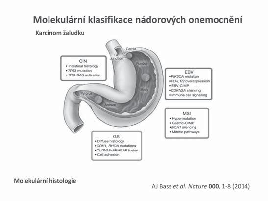 Přínos molekulární genetiky pro diagnostiku a terapii malignit GIT v posledních 10 letech 16