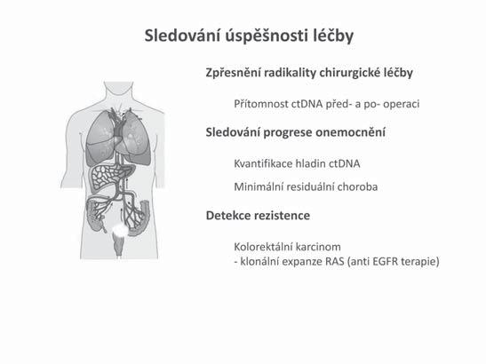 Přínos molekulární genetiky pro diagnostiku a