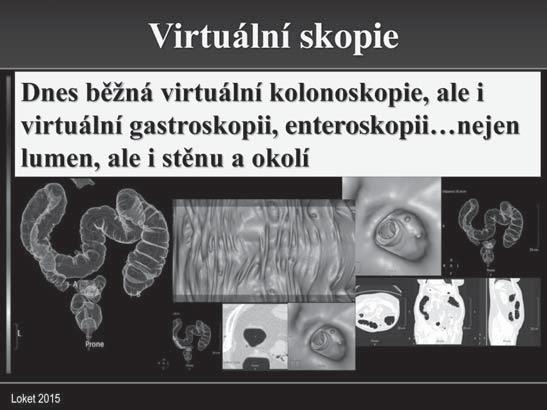 Dochází v diagnostice malignit GIT k