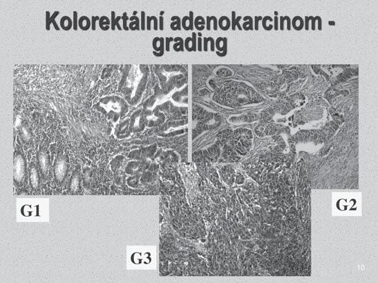 Klíčové postavení patologie v charakterizaci