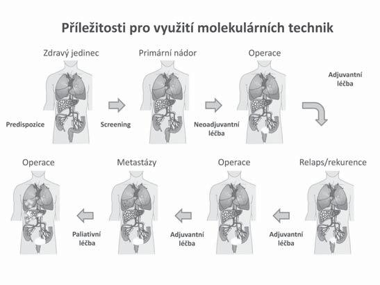 Přínos molekulární genetiky pro diagnostiku a terapii malignit GIT v posledních 10 letech XXIV.