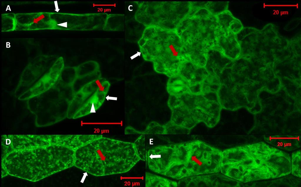 5.2 In vivo lokalizace PRF2-GFP v odpovědi na působení inhibitorů cytoskeletu 5.2.1 Lokalizace PRF2-GFP v buňkách A.