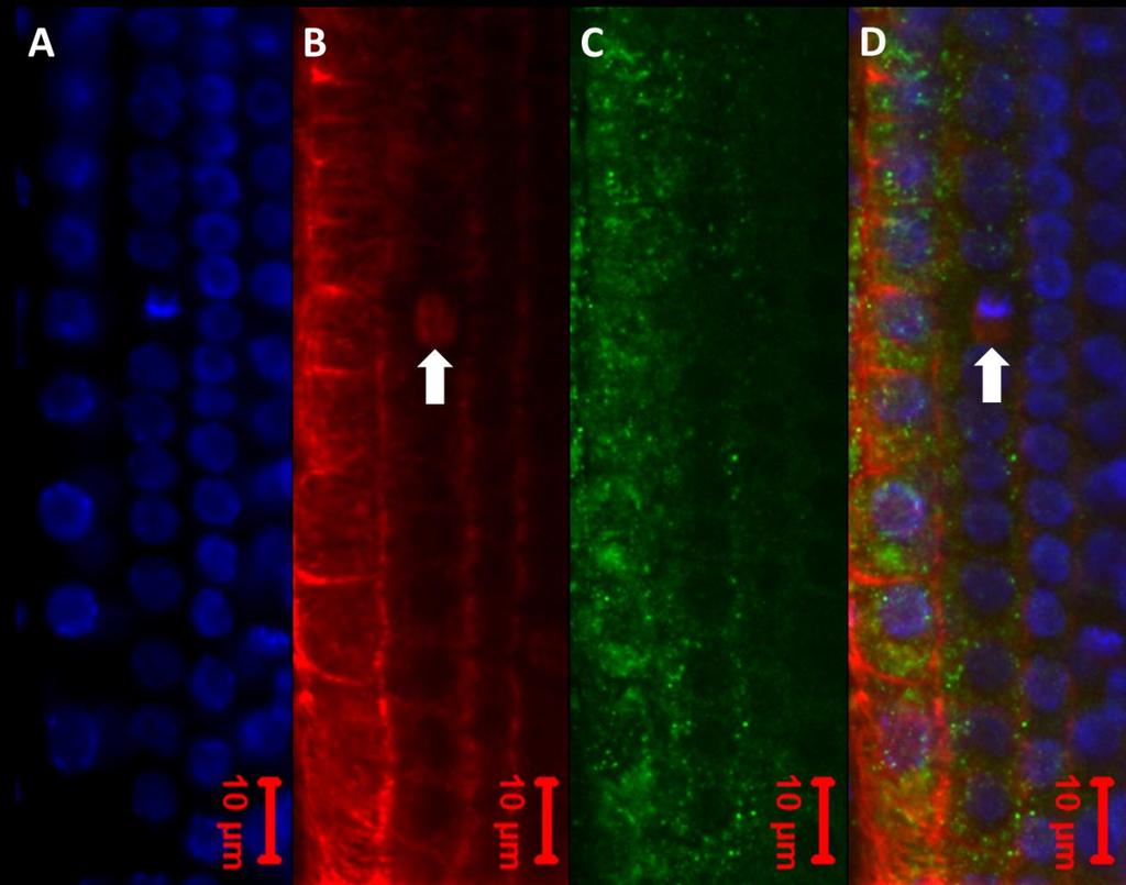 5.3 Imunocytochemické studium cytoskeletu u transgenní linie PRF2-GFP metodou whole mount Metoda whole mount byla použita pro imunocytochemické studium organizace MT a AF v epidermálních kořenových