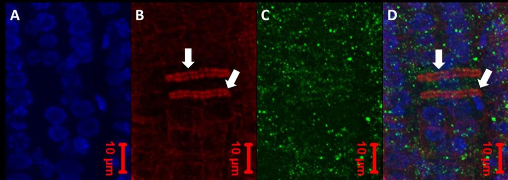 Obr. 27 Imunolokalizace MT a PRF2-GFP v epidermálních kořenových buňkách semenáčků transgenní linie PRF2-GFP.