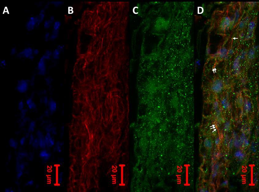 Meřítka odpovídají 10 µm. Obr.