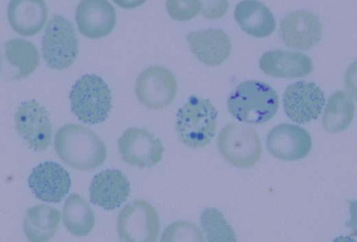 (Multiplex Ligation-dependent Probe Amplification) je založena na ligaci více párů prób (obvykle dlouhých), které hybridizují napříč k analyzované oblasti.