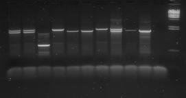 Nově jsme zavedli alelově specifickou PCR (ASO PCR), která umožníidentifikaci 6ti nejběžnějších α talasemických mutací ( α3.7, α4.2, α20.5, MED, SEA, FIL)(obr. 3).