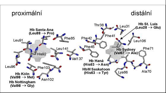 Obr. 8: Proximální a distální strana hemové kapsy se schematickým znázorněním několika aminokyselinových záměn v β-podjednotce hemoglobinu zjištěných v české a slovenské populaci (převzato z Divoký
