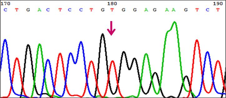 heterozygotní nosičství.