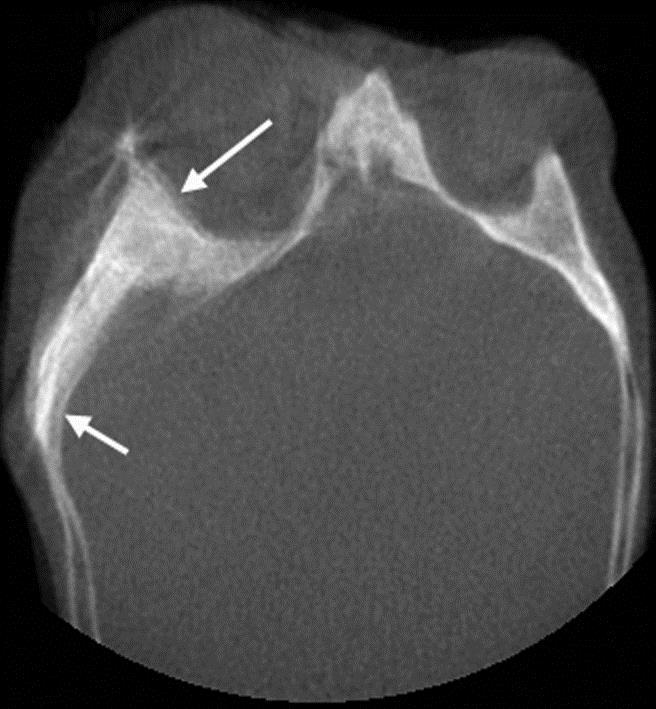 Respiration-Correlated Cone-Beam CT Předpoklad pravidelného dýchání Motion-Compensated Cone-Beam CT Analytické