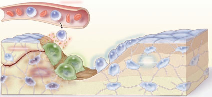 Apoptosa