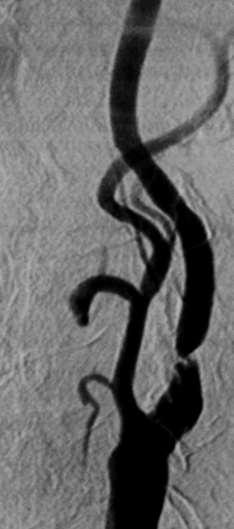 etiologie 