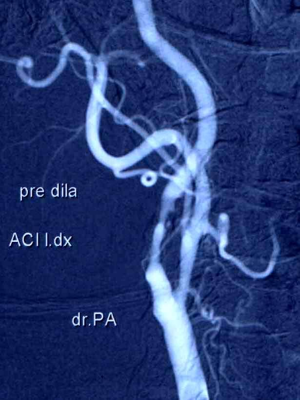 Neurochirurgie