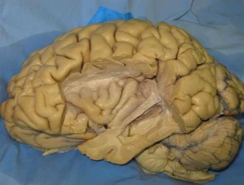 Cingulum