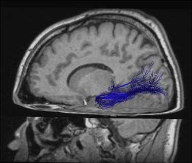 Fasciculus