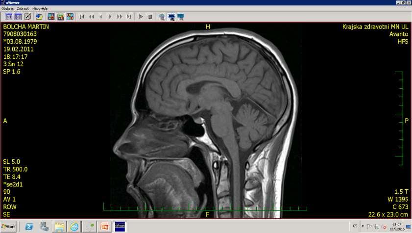 Axial MRI