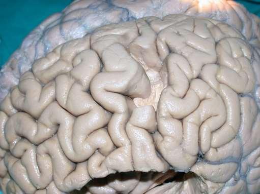Anatomie: gyrifikace prcg pcg F1 F2 prcg pcg F1 F2 Šipka g. precentralis g.