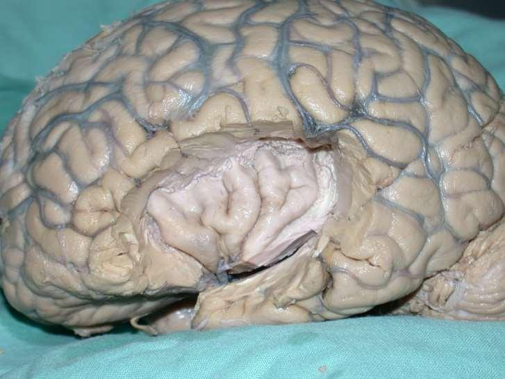 Insula